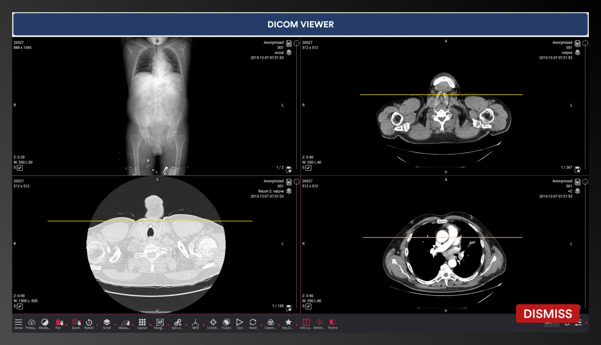 Interactive DICOM Viewer