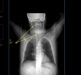 DICOM Image Viewing: An Important Element in Patient Communication_HCI